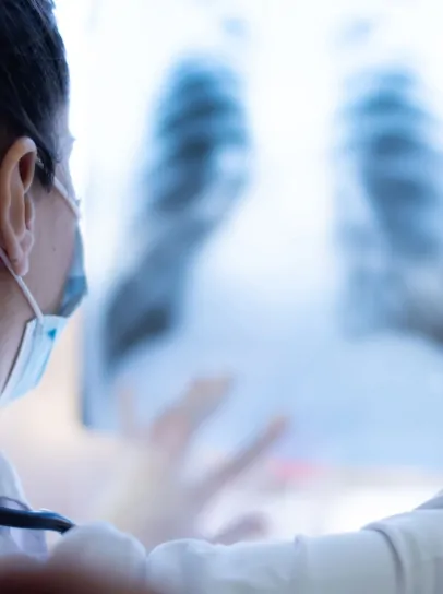 レントゲンを見る医者