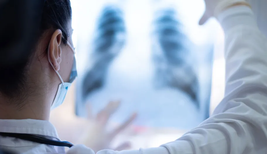 レントゲンを見る医者