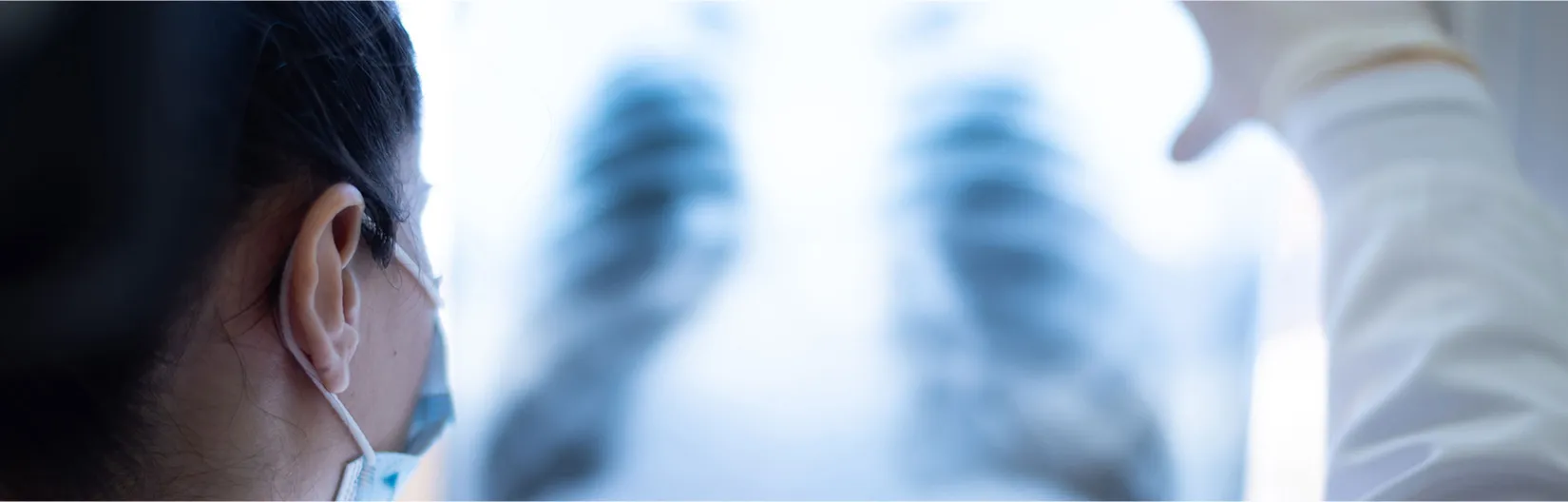 レントゲンを見る医者